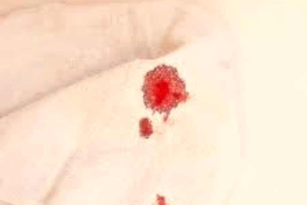 تمیز کردن لکه خون از لباس